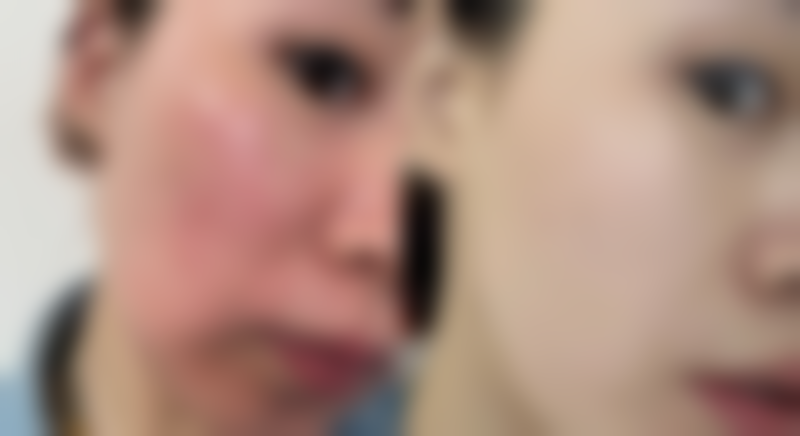 山西晋城芳华医疗美容医院口碑好不好？附真实患者口碑评价