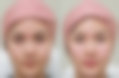 山西晋城芳华医疗美容医院价格表