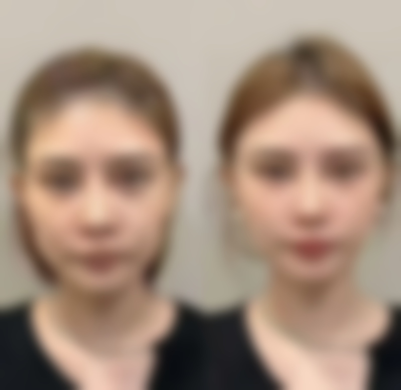 山西晋城芳华医疗美容医院怎么样，口碑评价如何？