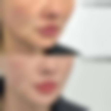 七、南宁市第一人民医院整形美容外科真实患者口碑评价