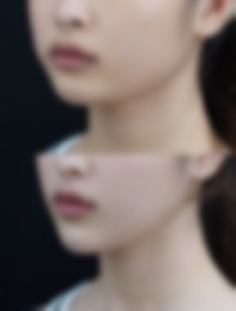 重庆美颜臣医院项目特色