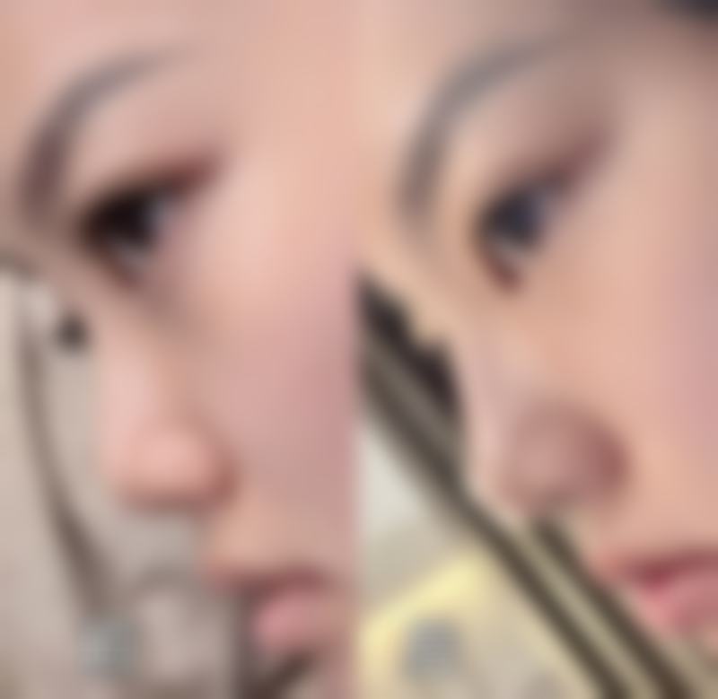 重庆美颜臣医院口碑好不好？附真实患者口碑评价