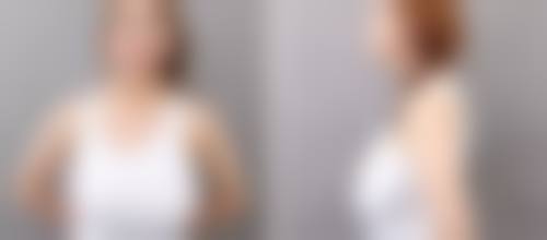 深圳星秀整形医院怎么样口碑好不好?附真实患者口碑评价