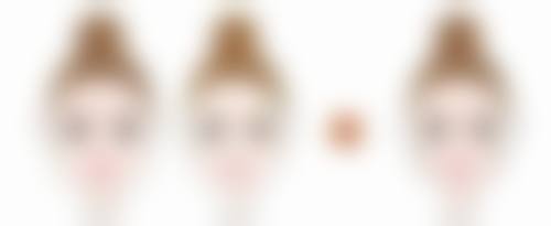 什么隆胸手术更好之如何选择更适合你的方案