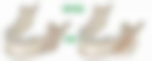 什么隆胸手术更好之安心性和修复速度大比拼