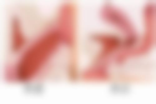 全身抽脂怎么抽的，专业医院详解吸脂全过程，三甲医生教你安全塑形