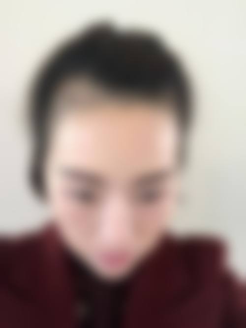 李文锋医生简介项目优势