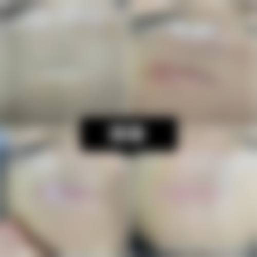 徐汉珍医生项目优势