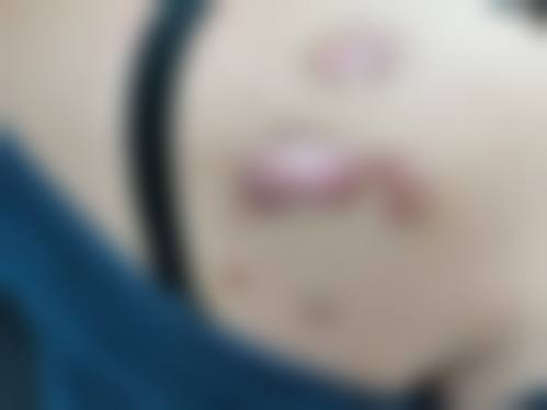 宜昌涞曼整形医院口碑好不好：附真实患者口碑评价