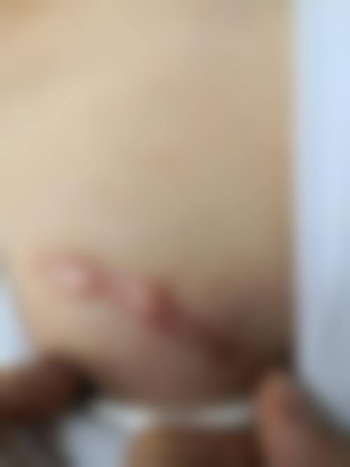 李文锋医生简介口碑如何