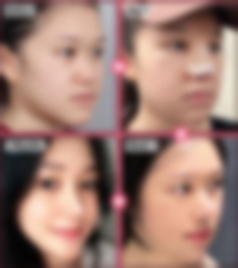 葛俊卿医生简介之做手术价格