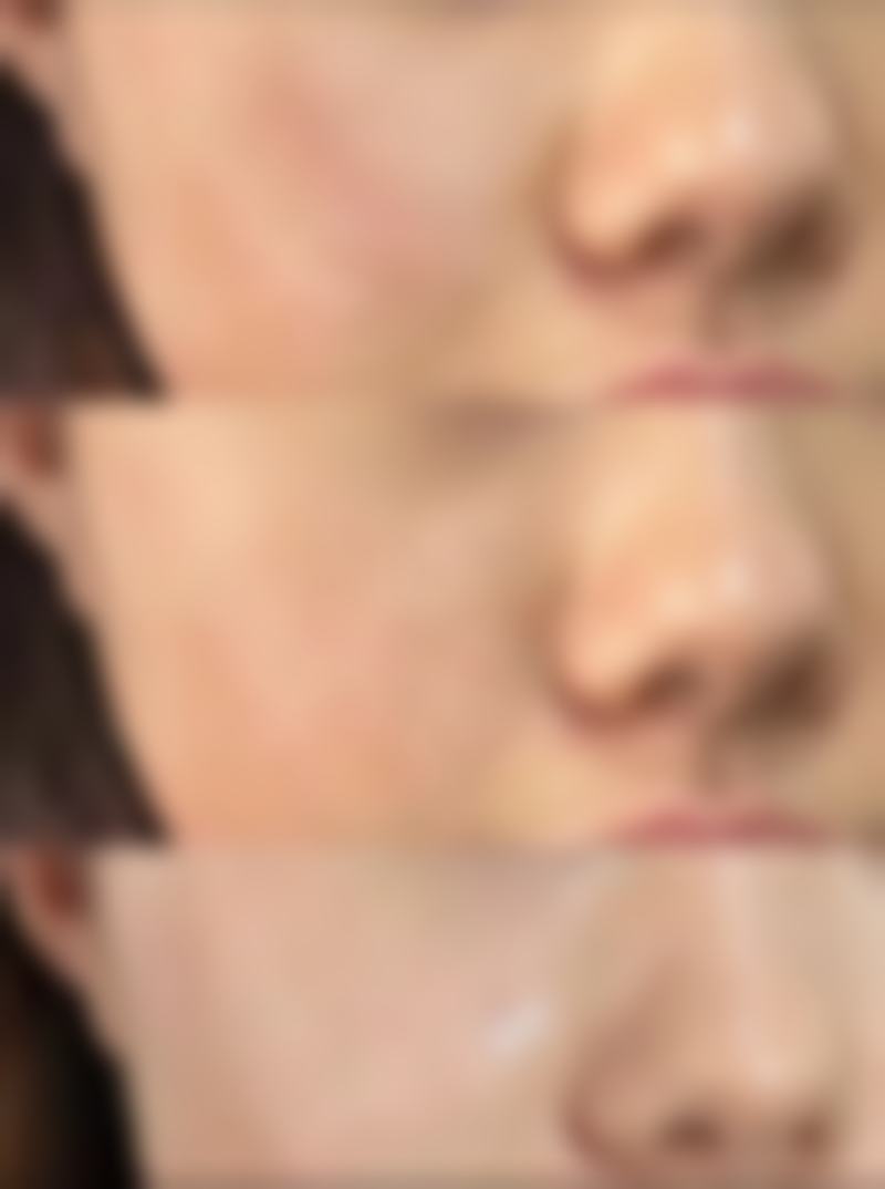 打瘦脸针后面部僵硬怎么办之快速缓解妙招