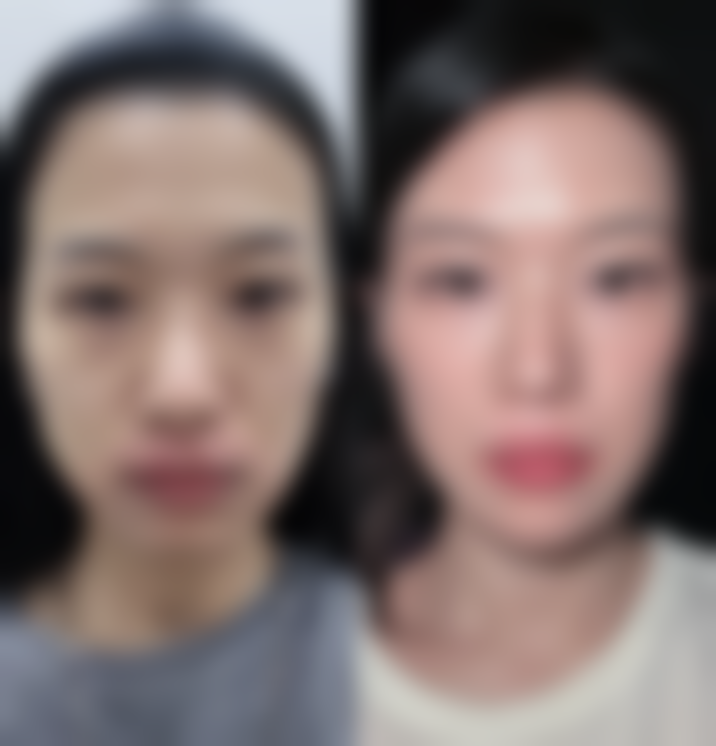 朱刚强医生挂号方式指南