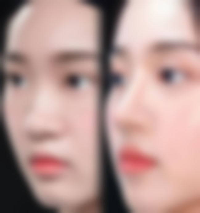 别让“脸僵”影响你的美