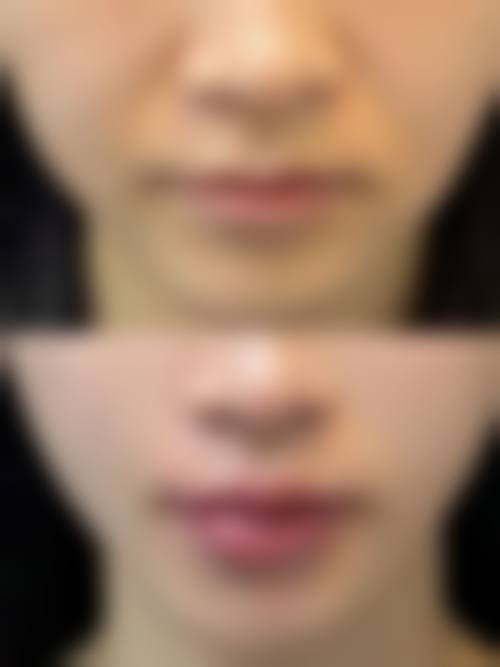 济南天逸美医疗美容诊所怎么样?更擅长什么手术