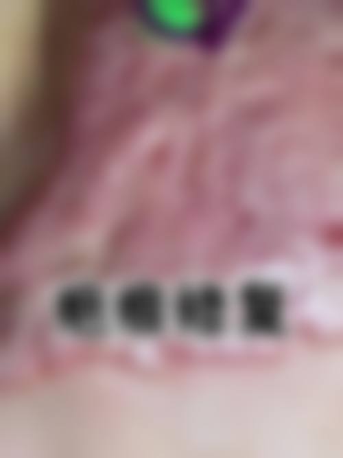 葛俊卿医生简介之做手术价格