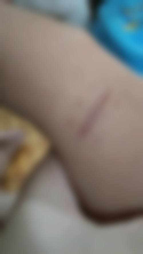 卢迎春医生简介做手术价格