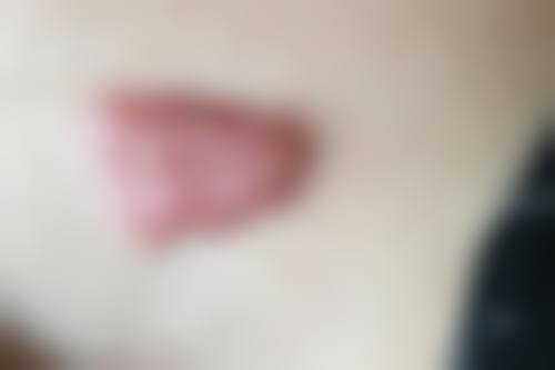 韩国世丽SERI整形外科医院口碑好不好？附真实患者口碑评价