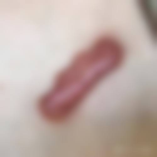 萍乡薇尚医疗美容诊所怎么样,评价