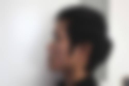 萍乡薇尚医疗美容诊所怎么样,价格表