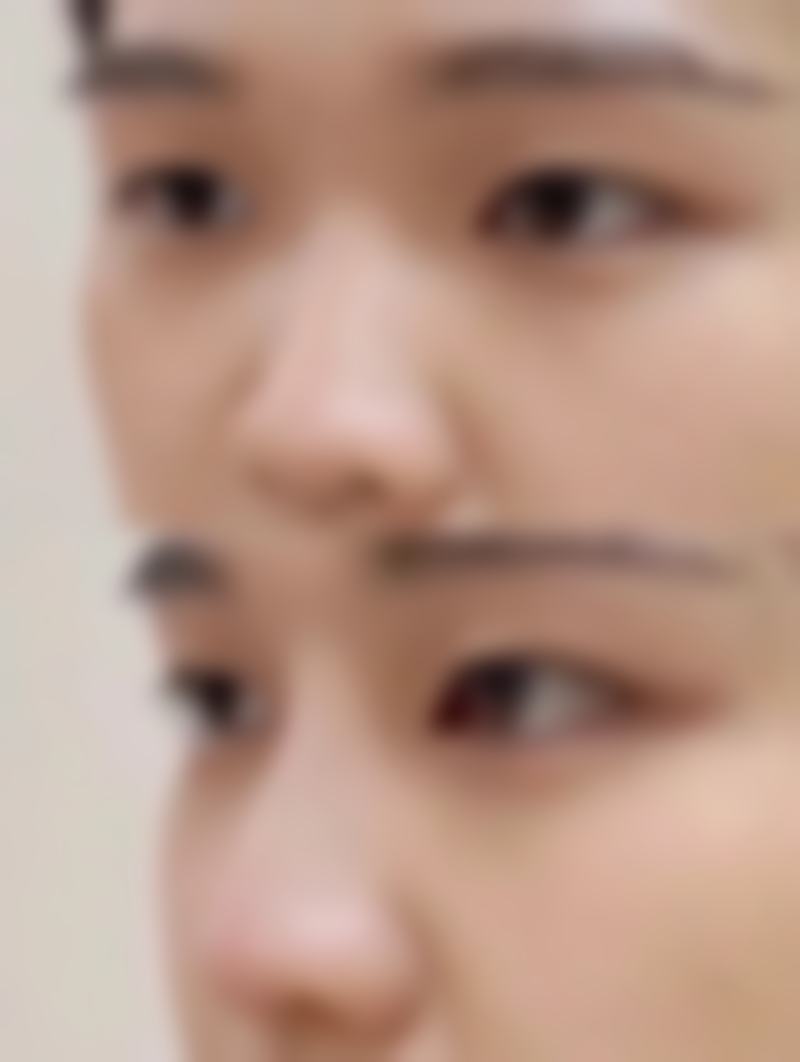 江苏宿迁奕美美容医院价格表