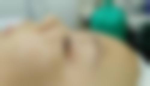 眼睛热敷去眼袋的正确实操方法——手把手带你逆袭