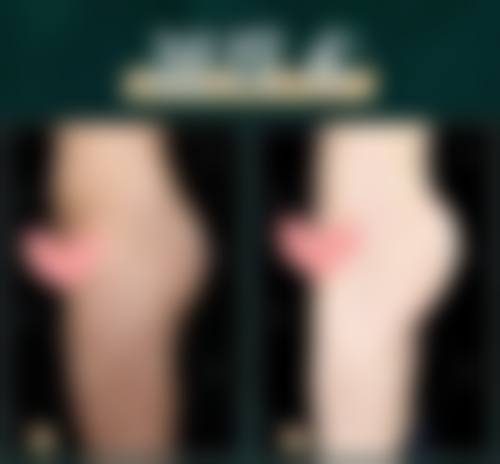 龚忠华医生简介口碑如何