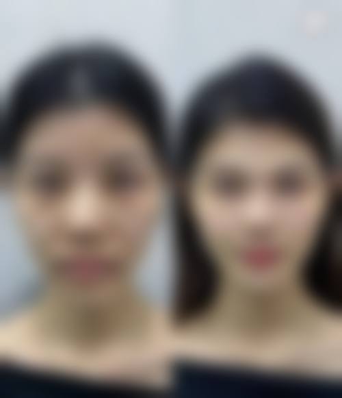 深圳联合丽格医疗美容诊所（福田店）更擅长什么手术