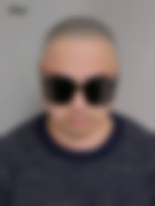 广州国姿整形医疗美容医院怎么样口碑好不好?附真实患者口碑评价