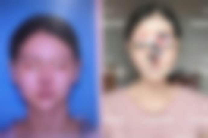 韩国英格整形医院口碑评价如何