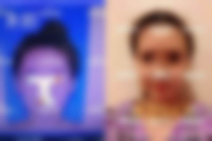 韩国英格整形医院价格表详情