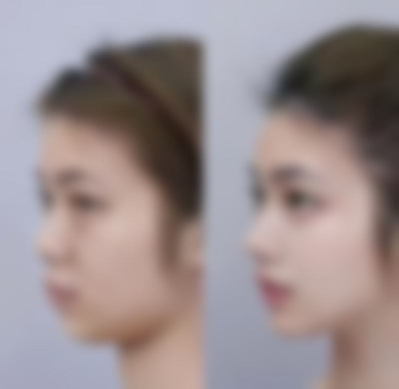 煮鸡蛋去眼袋的正确方法：手把手教学