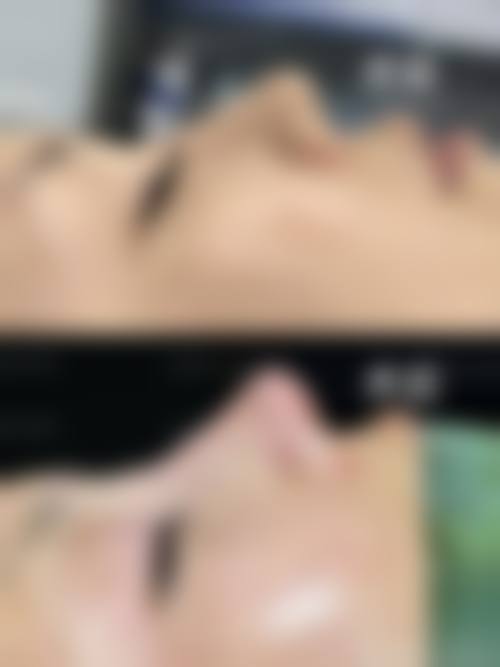 高顺福医生做手术价格