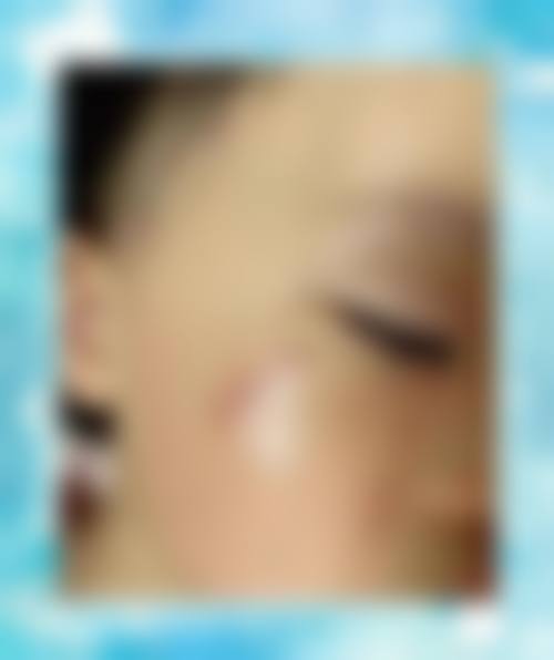 郴州青源医疗美容医院口碑好不好？附真实患者口碑评价