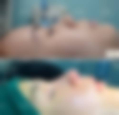 高顺福医生项目优势