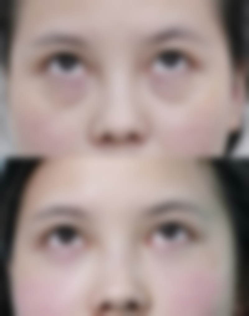 秦皇岛釹娃（原女娃）医疗美容诊所的价格表