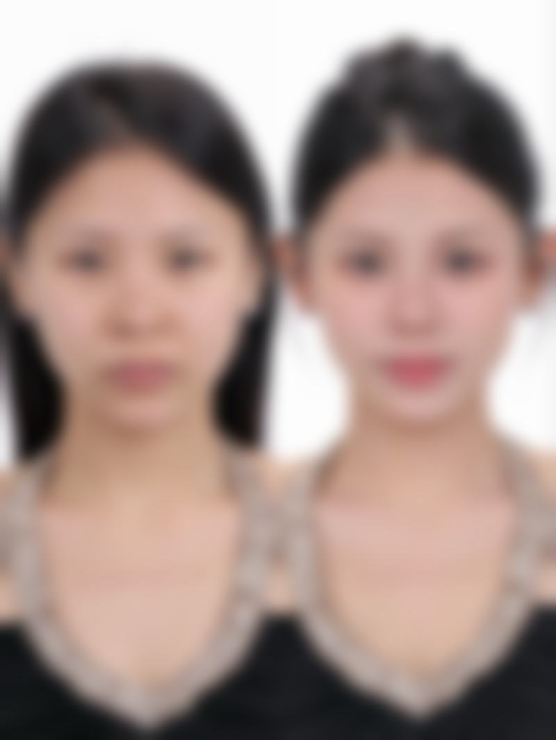 韩国美来整形医院真实患者口碑评价