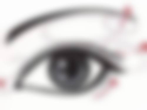 点痣后疤痕有点增生怎么办：激光治疗——精细打击顽固增生