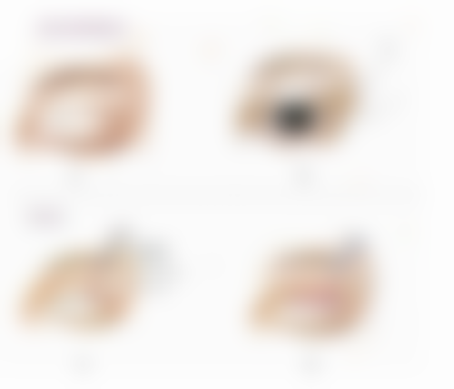 半肋骨隆鼻子恒久的成功几率与医院医生选择