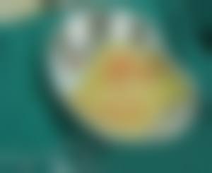 青岛美佳怡整形医院口碑好不好？附真实患者口碑评价