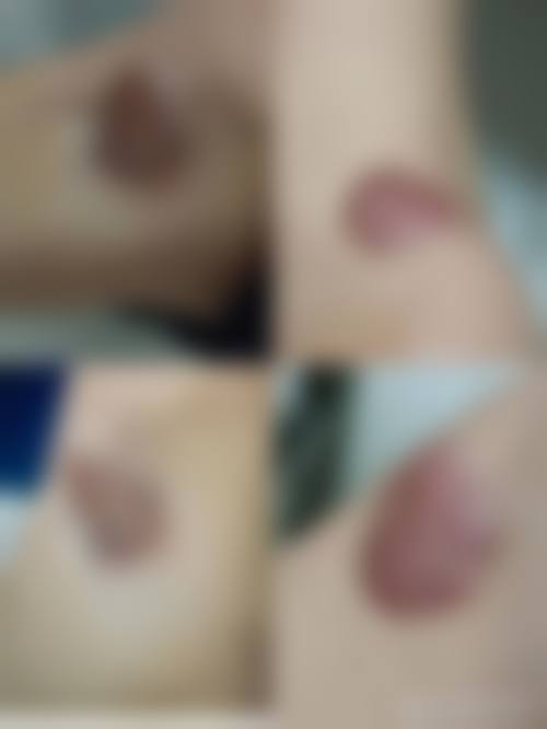 赤峰佳婳整形门诊部顾客实例