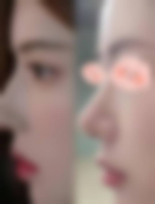 青岛美佳怡整形医院项目特色