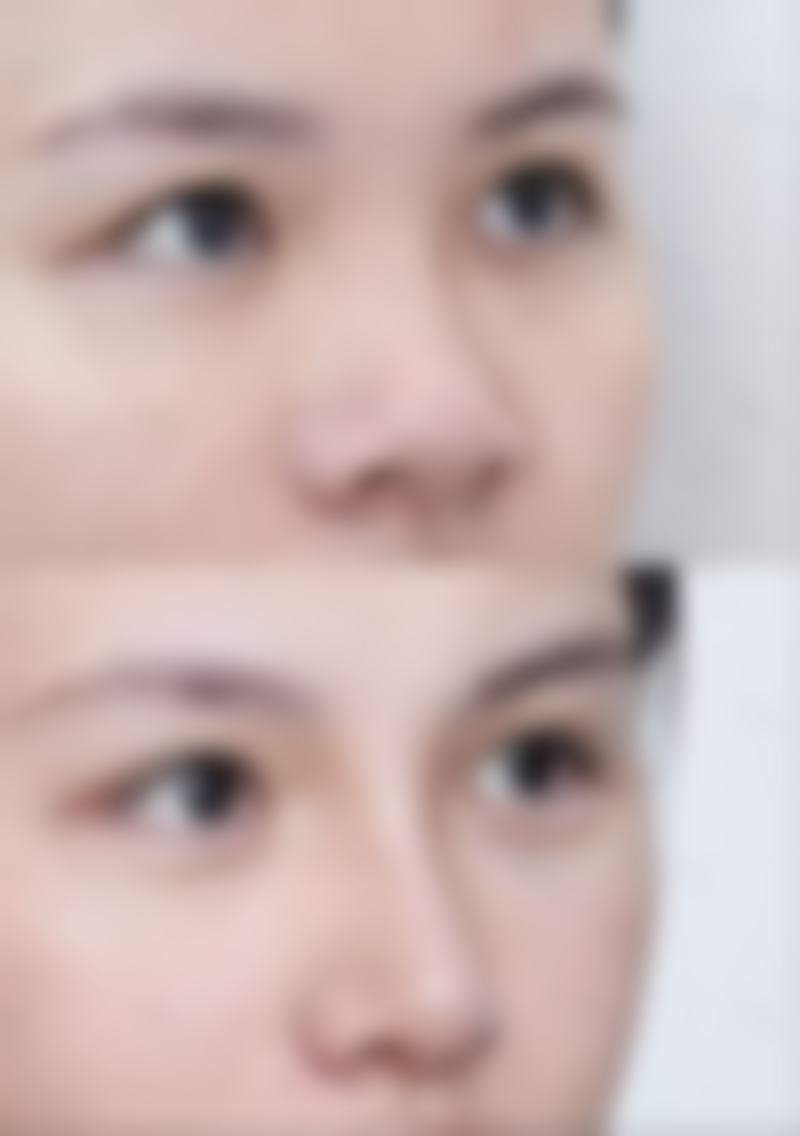 陈甫医生简介做手术价格