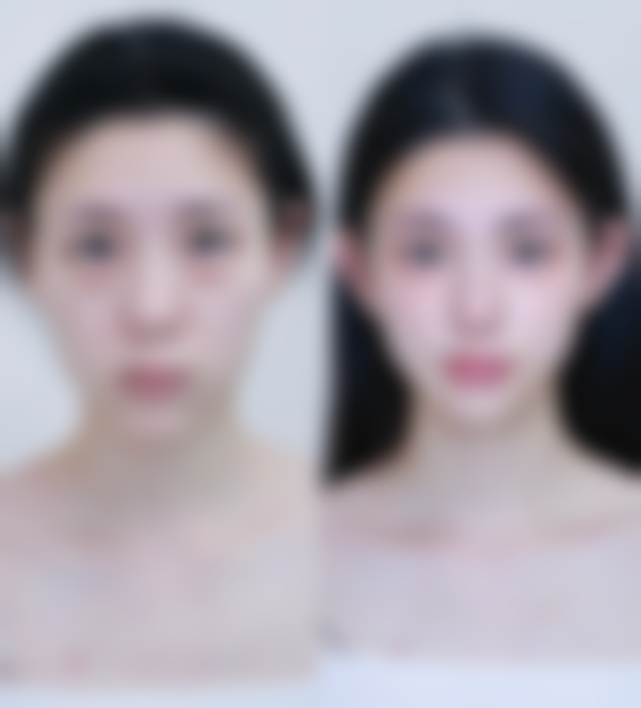 陈甫医生简介口碑如何