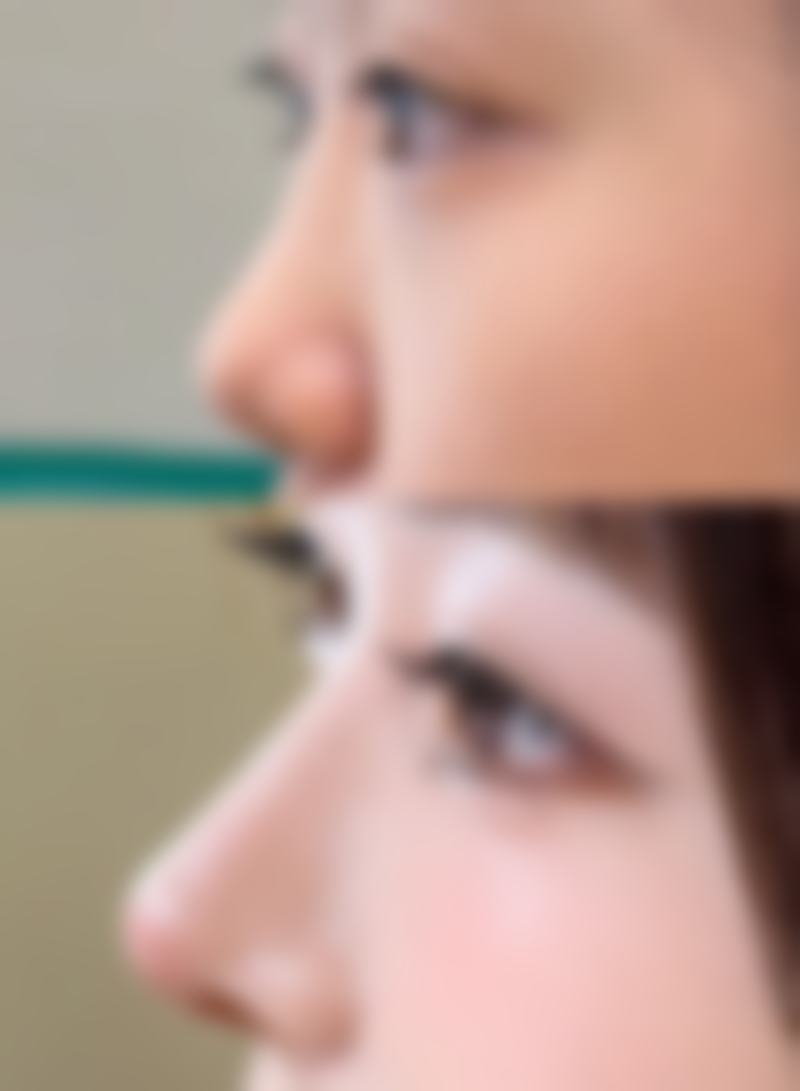 七、南京欣逸睿颜整形医院怎么样之真实口碑评价