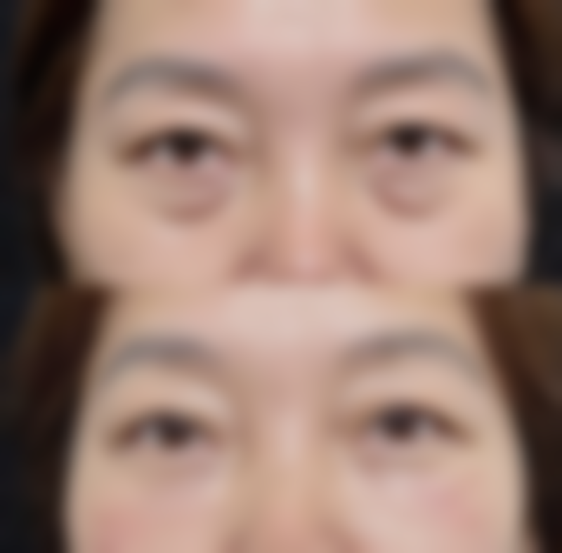 赤峰佳婳整形门诊部价格表