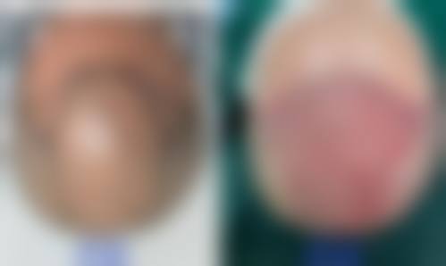 株洲奥拉克医疗美容诊所怎么样，可靠吗