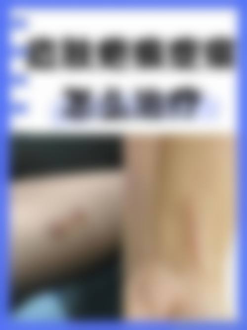 包头市鸿宾极光医疗美容的抖音团购活动及价格表