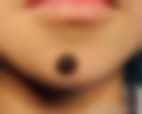 武汉谢想兵医疗美容诊所价格表