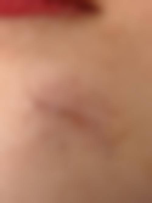 南京馨貌医疗美容诊所怎么样，评价